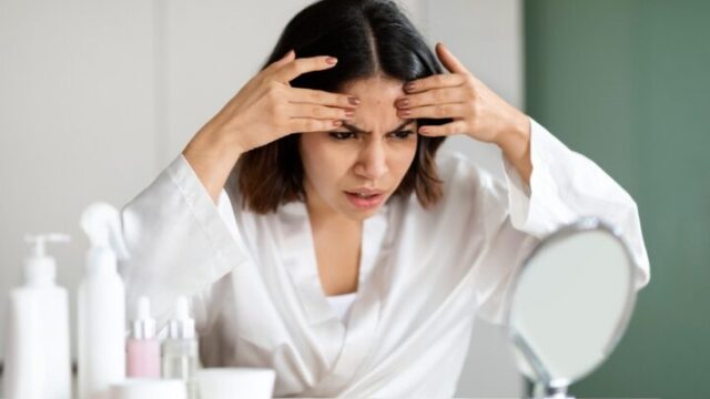 眉間ニキビのスピリチュアルな意味は？ニキビ占いのメッセージ